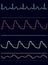 Electrocardiogram