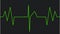 Electrocardiogram