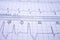 Electrocardiogram beats recorded on paper. Closeup to heart beat