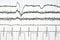 Electrocardiogram close up