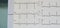 Electrocardiogram for detected abnormal heart rate in the patients who has clinical chest pain in the emergency room in hospital.