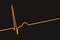 Electrocardiogram ECG displaying a junctional rhythm, 3D illustration