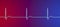 Electrocardiogram ECG displaying a junctional rhythm, 3D illustration