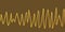 Electrocardiogram ECG displaying Torsades de pointes rhythm, 3D illustration