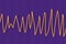Electrocardiogram ECG displaying Torsades de pointes rhythm, 3D illustration