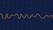 Electrocardiogram ECG displaying ventricular fibrillation rhythm, 3D illustration