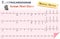 Electrocardiogram ( ECG , EKG ) of Ischemic Heart Disease ( Myocardial Infarction ) and Anatomy of heart icon