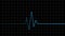 Electrocardiogram. Heartbeat waves