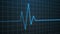 Electrocardiogram. Heartbeat waves