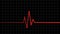 Electrocardiogram. Heartbeat waves