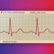 Electrocardiogram Paper with Normal ECG