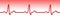 Electrocardiogram pulse graph