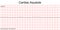 Electrocardiogram show Cardiac asystole pattern.