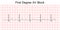 Electrocardiogram show first degree AV block pattern.