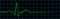 Electrocardiogram Showing Last Heart Beat