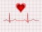 Electrocardiogram track