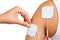 Electrodes of tens device on shoulder, tens therapy,