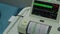 Electronic Cardiotocography Machine Monitoring Fetal Heart Contractions Of Uterus. Printing Cardiogram Report Coming Out