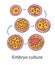 Embryo culture at in vitro fertilisation IVF