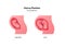 Embryo in womb medical diagram. Vector flat healthcare illustration. Uterus position during pregnancy. Single baby and twins.