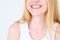 Emotion face smile woman teeth dentist oral health