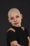 Emotional portrait of girl shaved bald.