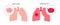 Emphysema anatomical poster