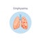 Emphysema chronic pulmonary disease diagram vector illustration isolated.