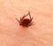 Encephalitis tick