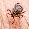 Encephalitis Tick Insect Crawling on Skin. Encephalitis Virus or Lyme Borreliosis Disease Infectious Dermacentor Tick Arachnid