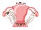 Endometriosis 4 stage Female reproductive system pain pcos tissue cancer cyst uterus. Front view. Human anatomy internal