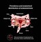 Endometriosis. The appearance of the disease . Endometrium. Colon. Small intestine. Infographics.