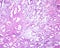 Endometrium. Secretory phase