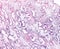 Endometrium. Secretory phase