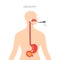 Endoscopy diagnostic,  concept in flat style