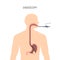 Endoscopy stomach anatomy equipment vector illustration. Esophagus endoscope body exam, gastroscopy human instrument