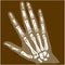 Engraving illustration of hand bone x-ray