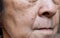 Enlarged pores in face of Asian, elder woman with skin folds