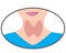 Enlarged Thyroid. Endocrine disfunction vector illustration on a white background