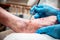 Epidermolysis bullosa, doctor removes scab and slough from the foot