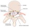 Epidural abscess