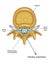 Epidural anesthesia diagram