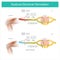 Epidural Electrical Stimulation. Muscle pain symptom in the leg area and treatment by electrical stimulation on skin and then