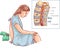 Epidural Nerve Block Injection illustration