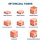 Epithelial tissue with labeled squamous, cuboidal and columnar examples.