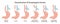 Esophageal atresia types set. Congenital medical condition of trachea