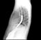 Esophagram or Barium swallow Lateral view  .