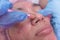 An Esthetician performs a Diamond peel facial, a type of microdermabrasion procedure. Exfoliating the skin of the face. At a