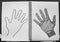 Evil hands, Hand drawn forehand and wound suture on white paper background,Halloween concept.