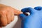 Examination by a dermatologist doctor papilloma warts on the patient`s hand and the doctor`s hand in a blue glove